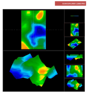 دستگاه فلزیاب طلایاب گنج یاب اسکن اکسپلورر پرو Scan Explorer 12000 Pro